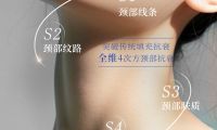SKINIST 4S 頸齡精雕｜養出天鵝頸